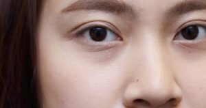 cara menghilangkan mata panda dengan minyak zaitun, cara menghilangkan mata panda dengan minyak zaitun mustika ratu, cara menghilangkan mata panda dengan minyak zaitun herborist, cara menghilangkan mata panda yang hitam, cara menghilangkan mata panda yang sudah parah, cara menghilangkan mata panda yang menghitam, cara menghilangkan mata panda yang sudah bertahun tahun, cara menghilangkan mata panda yg hitam, cara menghilangkan mata panda yang alami, cara menghilangkan mata panda yang susah hilang, cara menghilangkan mata panda yang parah, cara menghilangkan mata panda yg sudah parah, cara menghilangkan mata panda yg ampuh, cara menghilangkan mata panda wikihow, cara menghilangkan mata panda warna, cara menghilangkan mata panda dalam waktu 5 menit, cara menghilangkan mata panda dalam waktu 5 menit secara alami, cara menghilangkan mata panda di wajah, cara menghilangkan mata panda dalam waktu semalam, cara menghilangkan mata panda pada wajah, cara menghilangkan mata panda dalam waktu 3 hari, cara menghilangkan mata panda dengan produk wardah, cara menghilangkan mata panda dengan aloe vera wardah, cara menghilangkan mata panda dengan vaseline, cara menghilangkan mata panda menggunakan vaseline, cara menghilangkan mata panda dengan aloe vera, cara menghilangkan mata panda dengan aloe vera nature republic, cara menghilangkan mata panda dengan aloe vera gel, cara menghilangkan mata panda dengan aloe vera dan air mawar, cara menghilangkan mata panda pakai aloe vera, cara menghilangkan mata panda dengan air mawar viva, video cara menghilangkan mata panda, cara menghilangkan mata panda untuk anak kecil, cara menghilangkan mata panda untuk remaja, cara menghilangkan mata panda untuk pria, cara menghilangkan mata panda dengan make up, cara untuk menghilangkan mata panda secara alami, cara untuk menghilangkan mata panda dengan cepat, bagaimana cara menghilangkan mata panda dengan make up, cara bermake up menghilangkan mata panda, cara membuat masker untuk menghilangkan mata panda, cara menggunakan tomat untuk menghilangkan mata panda, cara menghilangkan mata panda timun, cara menghilangkan mata panda turunan, cara menghilangkan mata panda tercepat, cara menghilangkan mata panda tanpa timun, cara menghilangkan mata panda terbaik, cara menghilangkan mata panda dengan timun, cara menghilangkan mata panda dengan teh, cara menghilangkan mata panda dengan tomat, cara menghilangkan mata panda dengan teh celup, cara menghilangkan mata panda dengan timun dan aloe vera, cara menghilangkan mata panda secara alami, cara menghilangkan mata panda secara alami cepat dan permanen, cara menghilangkan mata panda secara permanen, cara menghilangkan mata panda secara cepat dan alami, cara menghilangkan mata panda secara alami dengan cepat, cara menghilangkan mata panda setelah menangis, cara menghilangkan mata panda saat hamil, cara menghilangkan mata panda secara alami dengan timun, cara menghilangkan mata panda sejak lahir, cara menghilangkan mata panda secara, cara menghilangkan mata panda pada remaja, cara menghilangkan mata panda dengan vaseline repairing jelly, cara menghilangkan mata panda dengan nature republic, review cara menghilangkan mata panda, resep cara menghilangkan mata panda, cara menghilangkan rasa mata panda, cara menghilangkan mata panda permanen, cara menghilangkan mata panda pada anak, cara menghilangkan mata panda pakai timun, cara menghilangkan mata panda pakai sendok, cara menghilangkan mata panda pake teh, cara menghilangkan mata panda pada pria, cara menghilangkan mata panda pakai es batu, cara menghilangkan mata panda pakai tomat, cara menghilangkan mata panda pakai teh celup, cara menghilangkan mata panda dengan odol, cara menghilangkan mata panda dr oz, cara menghilangkan mata panda dengan obat, cara menghilangkan mata panda dengan baby oil, cara menghilangkan mata panda pakai baby oil, obat cara menghilangkan mata panda, ok google cara menghilangkan mata panda, cara menghilangkan mata panda habis nangis, cara menghilangkan mata panda dengan jeruk nipis, penyebab mata panda dan cara menghilangkan nya, cara menghilangkan mata panda menggunakan mentimun, cara menghilangkan mata panda menggunakan sendok, cara menghilangkan mata panda menggunakan teh, cara menghilangkan mata panda menggunakan bahan alami, cara menghilangkan mata panda menggunakan air mawar, cara menghilangkan mata panda menggunakan teh celup, cara menghilangkan mata panda menggunakan lidah buaya, cara menghilangkan mata panda menggunakan es batu, cara menghilangkan mata panda menggunakan baby oil, cara menghilangkan mata panda laki laki, cara menghilangkan mata panda dengan lidah buaya, cara menghilangkan mata panda dengan lemon, cara menghilangkan mata panda bawaan lahir, cara menghilangkan mata panda dan lingkaran hitam, cara menghilangkan mata panda dari lahir, cara menghilangkan mata panda atau lingkaran hitam dimata, cara menghilangkan mata panda dengan lidah buaya dan timun, cara menghilangkan mata panda keturunan, cara menghilangkan mata panda karena keturunan, cara menghilangkan mata panda karena begadang, cara menghilangkan mata panda karena kurang tidur, cara menghilangkan mata panda keriput, cara menghilangkan mata panda karena kacamata, cara menghilangkan mata panda karena alergi, cara menghilangkan mata panda kecantikan, cara menghilangkan mata panda dengan kentang, cara menghilangkan mata panda dengan kopi, cara menghilangkan mata panda dengan jeruk lemon, cara jitu menghilangkan mata panda, cara menghilangkan jerawat dan mata panda, cara menghilangkan bekas jerawat dan mata panda, cara menghilangkan mata panda item, cara menghilangkan mata panda dengan irisan tomat, cara menghilangkan mata panda pada ibu hamil, cara menghilangkan mata panda secara instan, cara menghilangkan mata panda dalam islam, cara menghilangkan mata panda dengan irisan timun, cara menghilangkan mata panda dengan irisan mentimun, cara menghilangkan mata panda dalam bahasa inggris, cara menghilangkan mata panda hitam, cara menghilangkan mata panda hitam secara alami, cara menghilangkan mata panda hitam dalam waktu 5 menit, cara menghilangkan kantung mata panda hitam, cara menghilangkan mata panda dengan teh hijau, cara menghilangkan mata panda dengan teh hijau dan kapas, cara menghilangkan mata panda dan garis halus, cara menghilangkan mata panda genetik, cara menghilangkan mata panda garnier, cara menghilangkan mata panda dengan pasta gigi, cara menghilangkan mata panda dengan air garam, gimana cara menghilangkan mata panda, cara menghilangkan mata panda faktor keturunan, cara menghilangkan mata panda female daily, cara menghilangkan mata panda karena faktor genetik, cara menghilangkan mata panda di foto, cara menghilangkan mata panda dan flek hitam, cara menghilangkan flek mata panda, cara alami menghilangkan flek dan mata panda, cara menghilangkan mata panda es batu, cara menghilangkan mata panda dengan es batu, cara menghilangkan mata panda dengan es, cara menghilangkan mata panda paling efektif, cara menghilangkan mata panda secara efektif, cara menghilangkan mata panda dengan eye cream, cara menghilangkan mata panda dengan air es, cara menghilangkan mata panda dengan cepat, cara menghilangkan mata panda dengan sendok, cara menghilangkan mata panda dalam semalam, cara menghilangkan mata panda dengan air mawar, cara menghilangkan mata panda cepat, cara menghilangkan mata panda cowok, cara menghilangkan mata panda cepat alami, cara menghilangkan mata panda.com, cara menghilangkan mata panda dengan cepat dan permanen, cara menghilangkan mata panda dan cekung, cara menghilangkan mata panda dengan cream, cara menghilangkan mata panda dengan cuka apel, cara menghilangkan mata panda dengan concealer, cara menghilangkan mata panda bengkak, cara menghilangkan mata panda bahan alami, cara menghilangkan mata panda brainly, cara menghilangkan mata panda bagian atas, cara menghilangkan mata panda bawaan, cara menghilangkan mata panda besar, cara menghilangkan mata panda berat, cara menghilangkan mata panda akibat begadang, cara menghilangkan mata panda alami, cara menghilangkan mata panda alami dan cepat, cara menghilangkan mata panda akibat kurang tidur, cara menghilangkan mata panda ala korea, cara menghilangkan mata panda ala dokter, cara menghilangkan mata panda alodokter, cara menghilangkan mata panda ampuh dan cepat, cara menghilangkan mata panda akibat keturunan, cara menghilangkan mata panda,