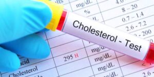 Ketahui Gejala Kolesterol Tinggi dan Cara Menurunkannya